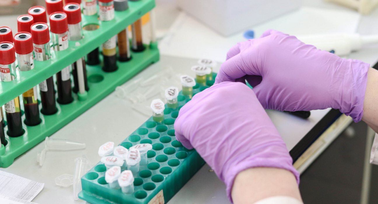 A researcher is wearing gloves and organising samples in a lab. A close-up of their hands and vials.