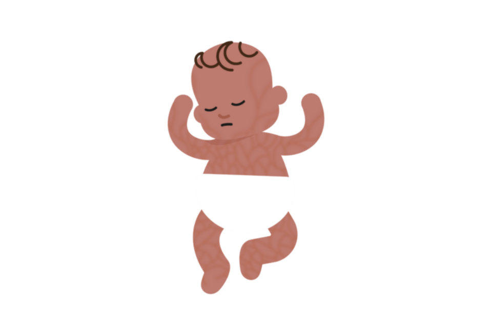 An illustration of a baby with fair skin but they look unwell. They are sleeping and have mottled skin.