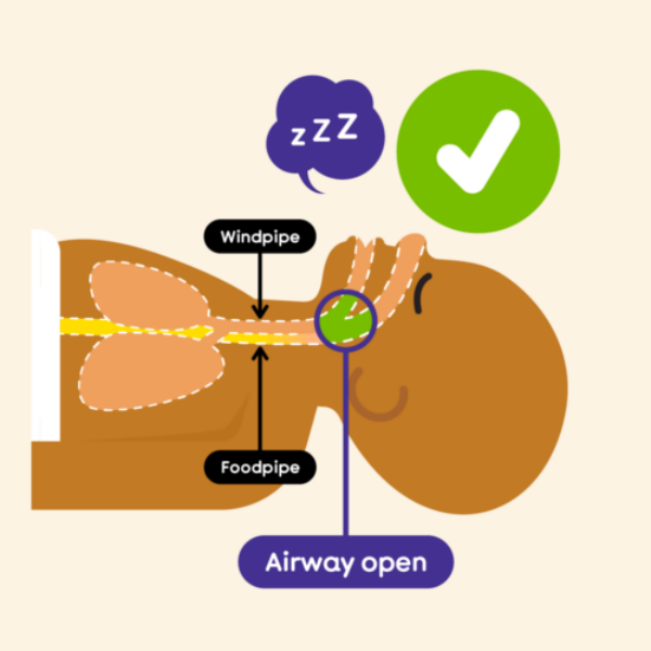 Illustration depicting a baby sleeping on their back and showing how open the baby's airways (ability to breathe) are. There is a tick to indicate this is the correct way to safe sleeping for babies.