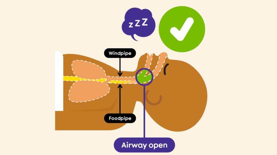 Illustration depicting a baby sleeping on their back and showing how open the baby's airways (ability to breathe) are. There is a tick to indicate this is the correct way to safe sleeping for babies.