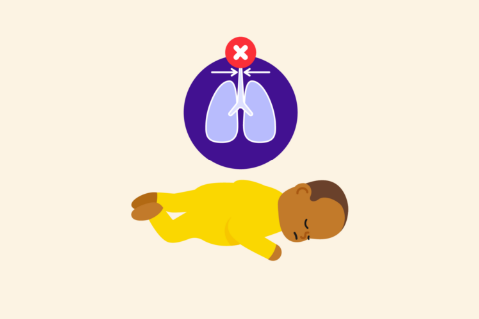 Illustration depicting baby in an unsafe sleeping position, on their front. The baby's airway has become narrowed, and an illustration of the airway into the baby's lungs depicts this.