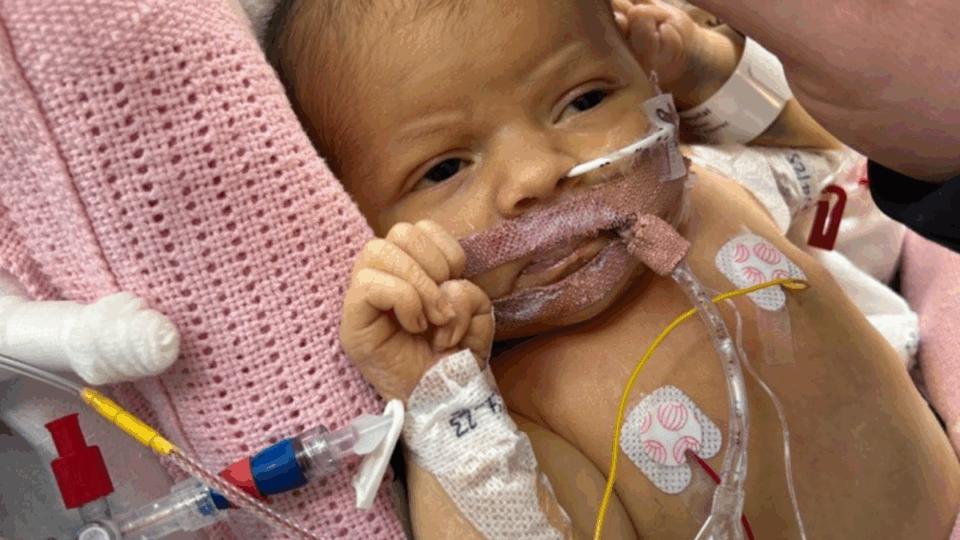 Baby Violet lying down, with various tubes attached to her.